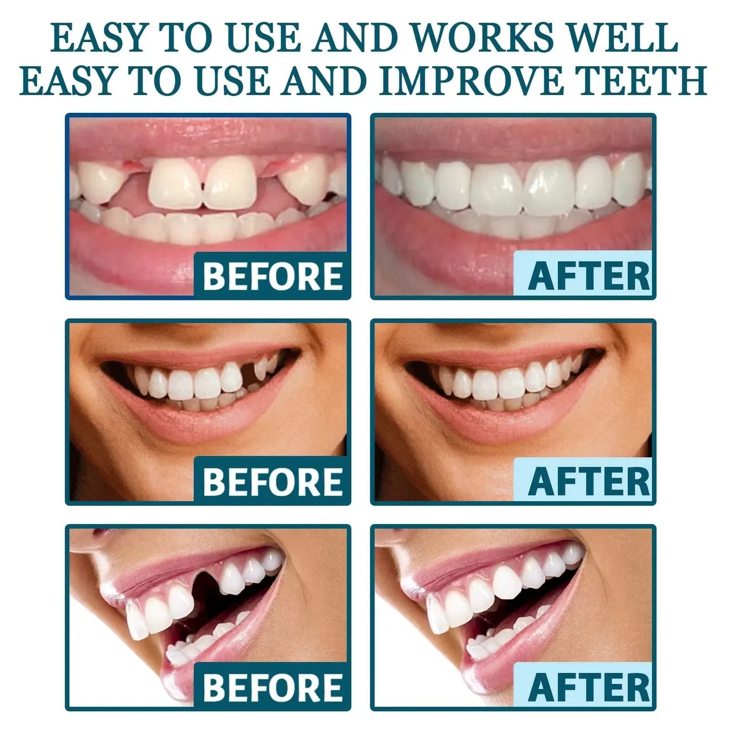 Flexyasmile™ | High-End Veneers. Perfect Smile in 2 Minutes